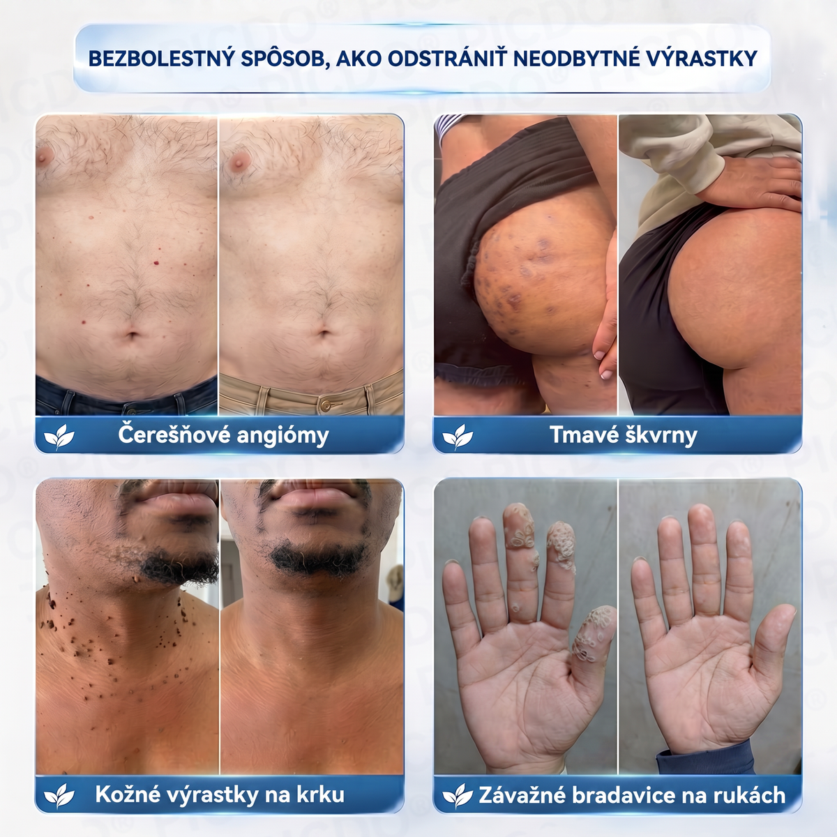 𝑷𝒊𝒄𝒅𝒐® 7-𝒅ň𝒐𝒗ý 𝒌𝒓é𝒎 𝒏𝒂 𝒌𝒐ž𝒏é 𝒗ý𝒓𝒂𝒔𝒕𝒌𝒚 𝒂 𝒑𝒊𝒈𝒎𝒆𝒏𝒕𝒐𝒗é š𝒌𝒗𝒓𝒏𝒚 ✅(𝒃𝒆𝒛𝒃𝒐𝒍𝒆𝒔𝒕𝒏á 𝒇𝒐𝒓𝒎𝒖𝒍𝒂 – 𝒃𝒆𝒛 𝒋𝒂𝒛𝒊𝒆𝒗)🍉
