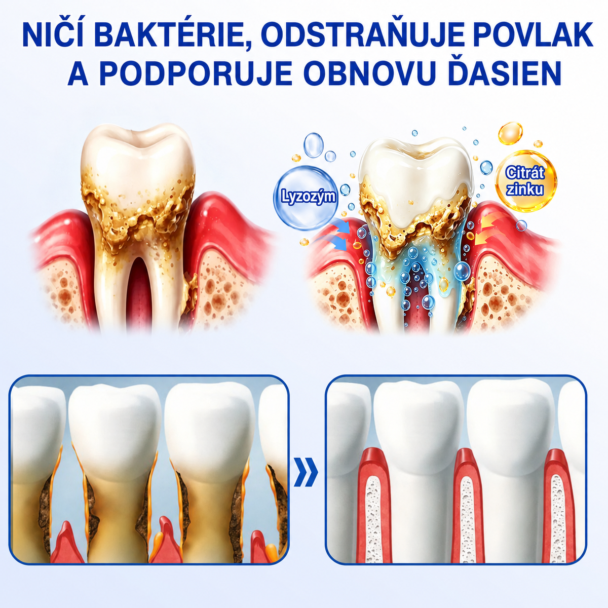 👨‍⚕️🦷 Evolvion® GumRevive regeneračný gél na parodont🎁