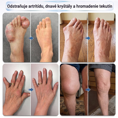 OFICIÁLNY OBCHOD | IFMAGIC® 0,05 mm Mikroneedle Rýchlo Pôsobiaci Roll-On na Úľavu Kĺbov a Kostí🎇