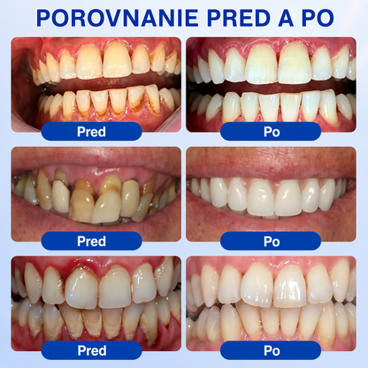 👨‍⚕️🦷 Evolvion® GumRevive regeneračný gél na parodont🎁
